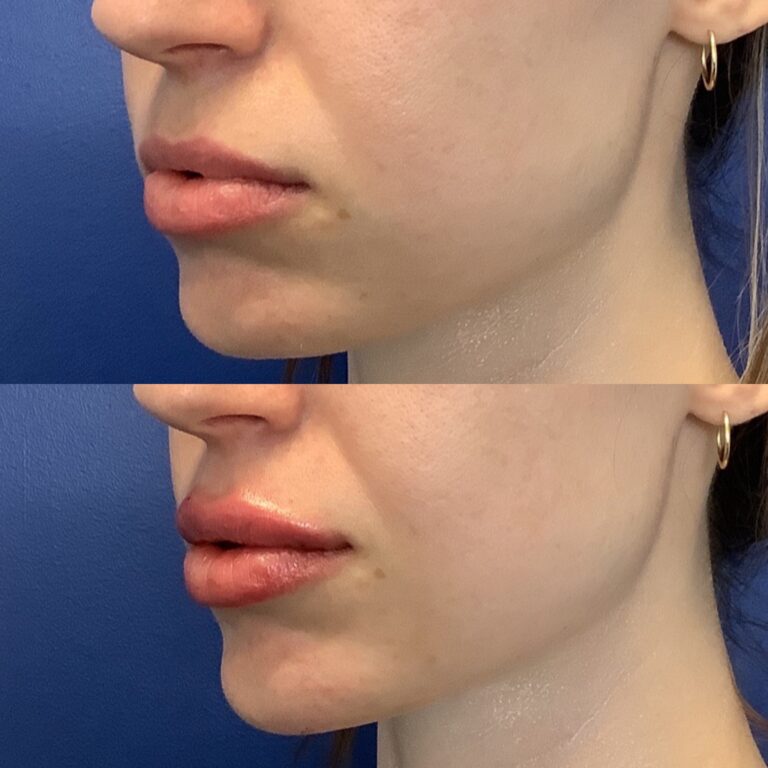 lips